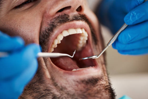 Best Oral Cancer Screening  in Plano, IL
